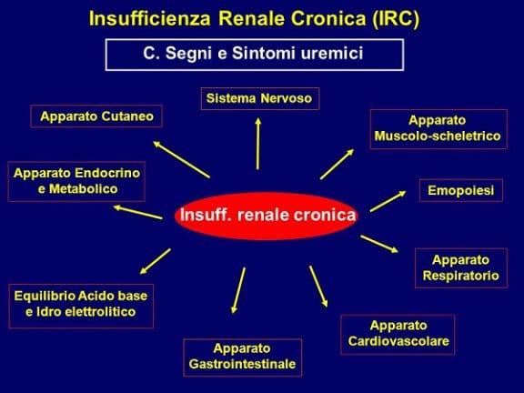 Insufficienza renale a cosa è dovuta e come si cura